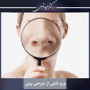 ورم ناشی از جراحی بینی | دکتر سعید فرهی 