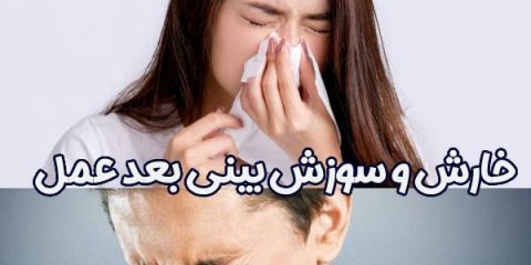 خارش و سوزش بینی بعد عمل - دکتر سعید فرهی