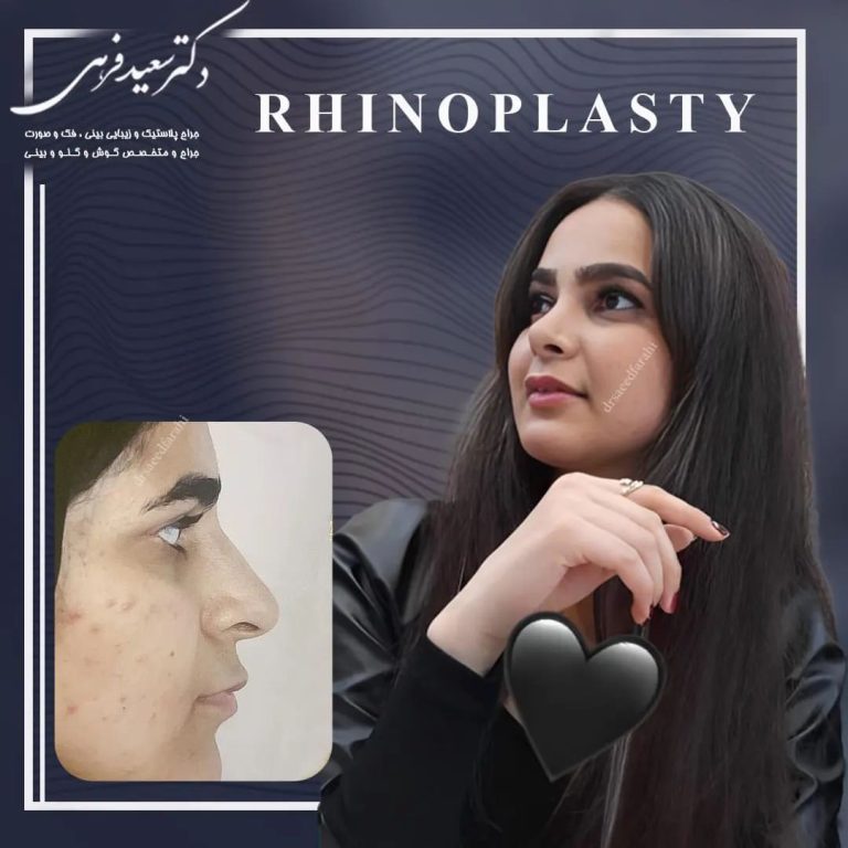 جراحی بینی طبیعی- دکتر سعید فرهی