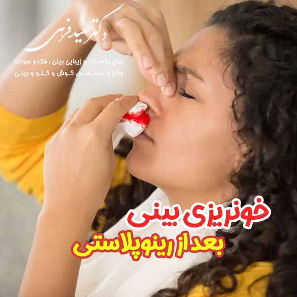 خونریزی بینی بعد از رینوپلاستی - دکتر سعید فرهی