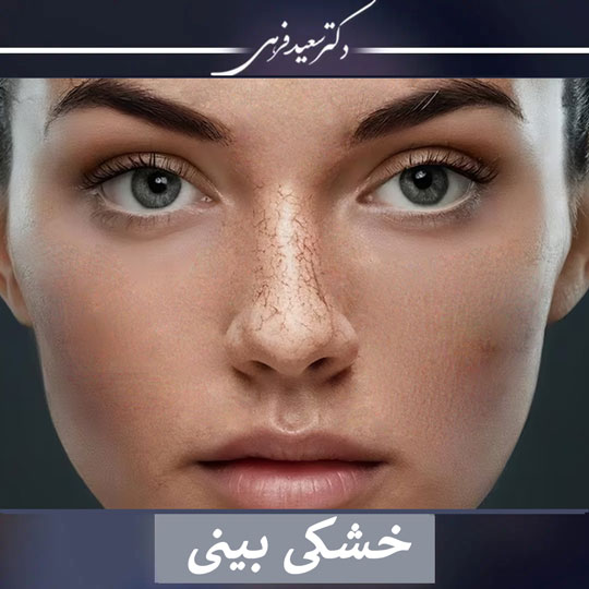 خشکی بینی قبل و بعد از عمل بینی