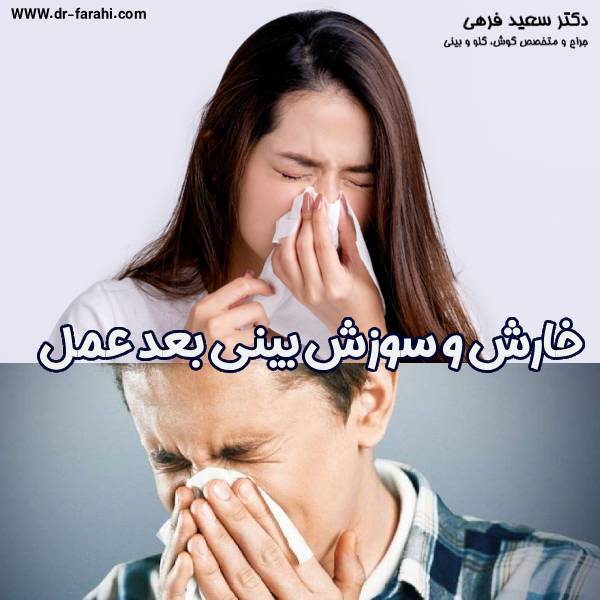 خارش و سوزش بینی بعد عمل - دکتر سعید فرهی