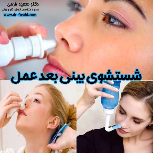 شستشوی بینی بعد عمل - دکتر سعید فرهی