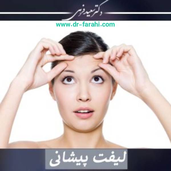 لیفت پیشانی + روش انجام و مزایا