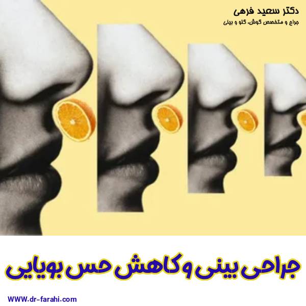 جراحی بینی و کاهش حس بویایی - دکتر سعید فرهی