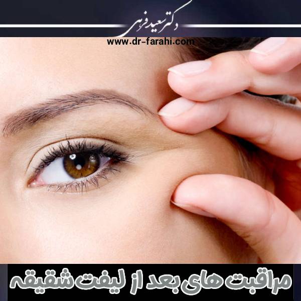 مراقبت های بعد از لیفت شقیقه + طول نقاهت