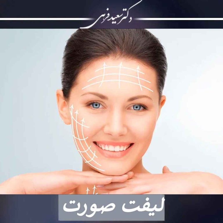 لیفت صورت - دکتر سعید فرهی