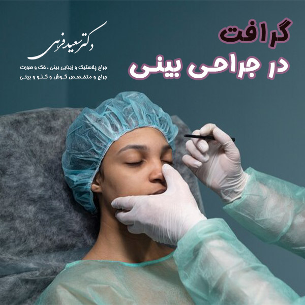گرافت در جراحی بینی - دکتر سعید فرهی - https://dr-farahi.com/