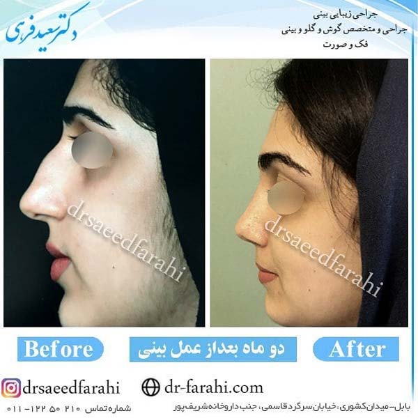 بهترین جراح بینی