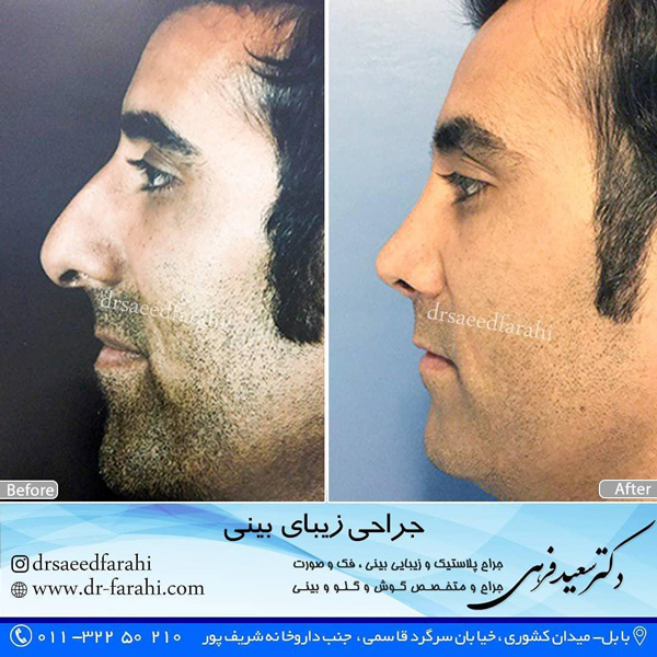 جراح بینی