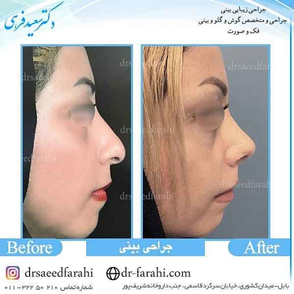 جراح زیبایی بینی