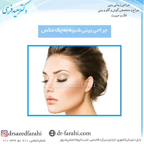 جراحی بینی شبیه به یک عکس