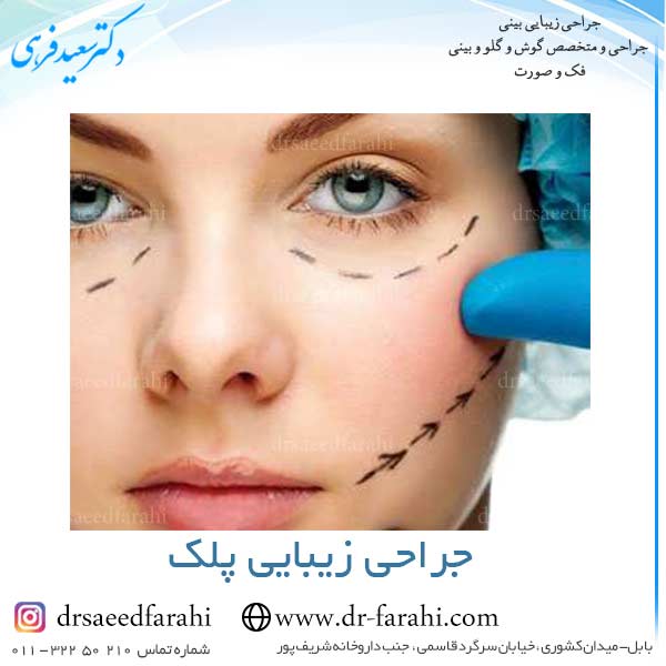 جراحی زیبایی پلک