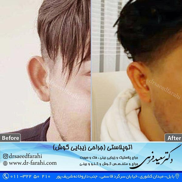 جراحی گوش در بابل - دکتر سعید فرهی (تصویر 2)