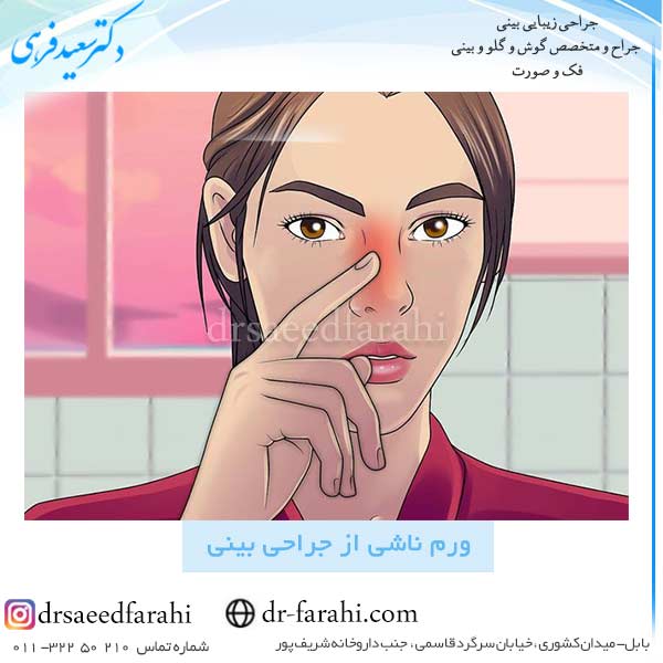 ورم ناشی از جراحی بینی