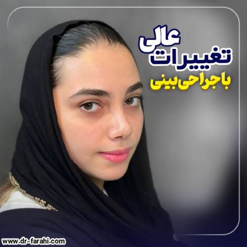 جراحی-بینی-در-بابل-175